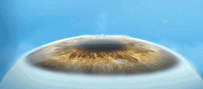 1727995795573794.gif